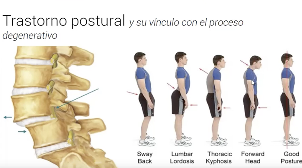 Qu es el tono muscular y qu es el tono vegetativo?